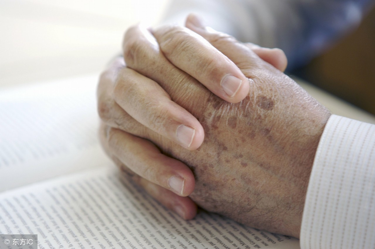老年斑什么样的,老年斑可以分为哪几种类型