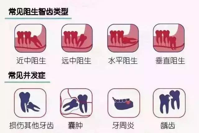 什么是智齿智齿需要拔除吗,小常识长了智齿到底该不该拔