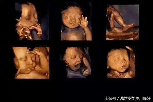 为什么做四维,和美家四维彩超临沂