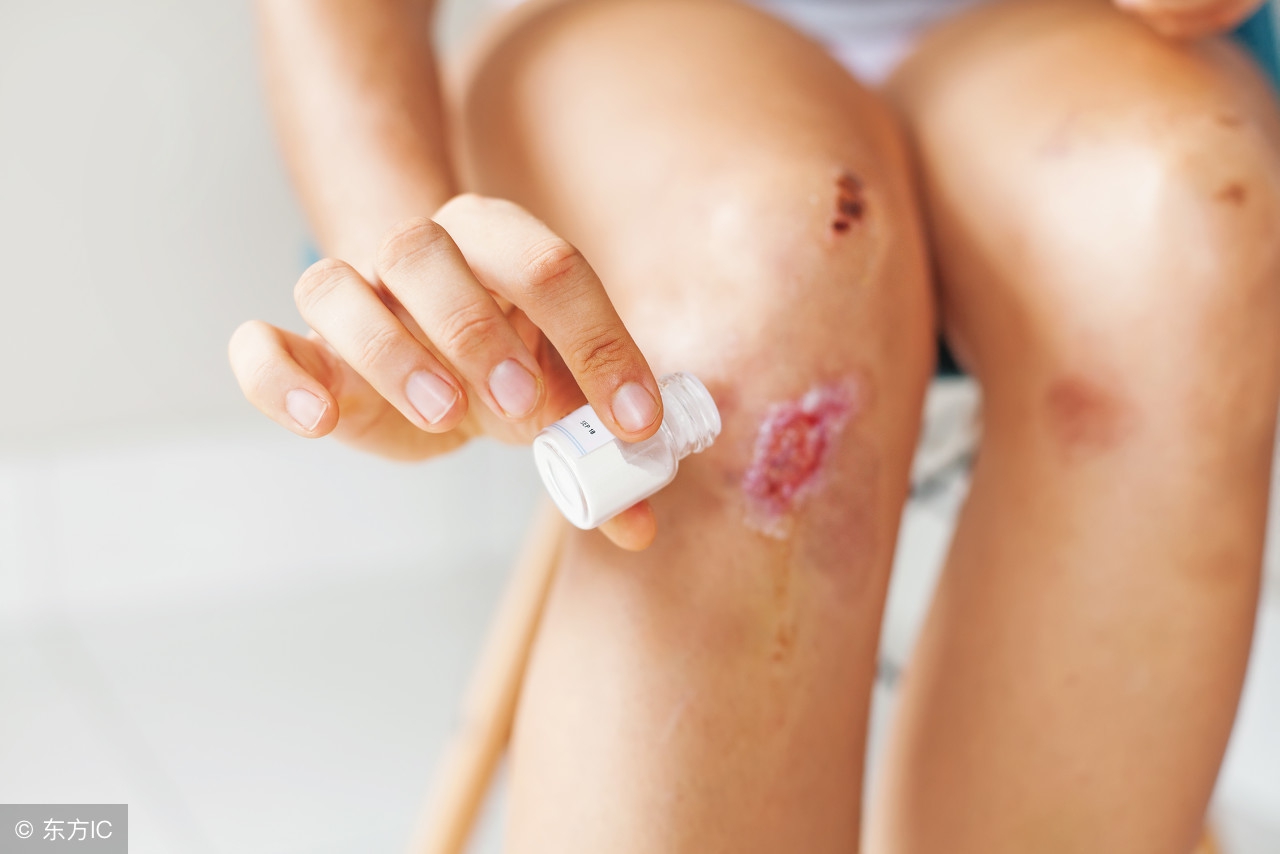 缺锌的症状用什么药,缺锌的症状怎么食疗