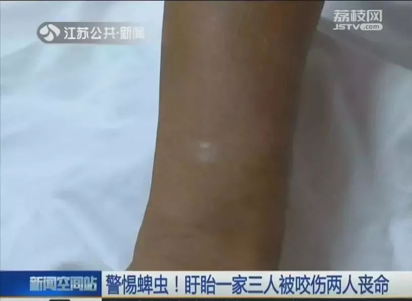 当心被虫子咬,当心有毒虫