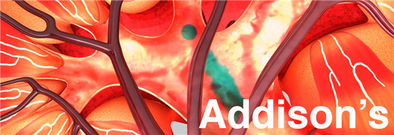 白癜风新药研发进度,银屑病生物制剂对白癜风有影响吗