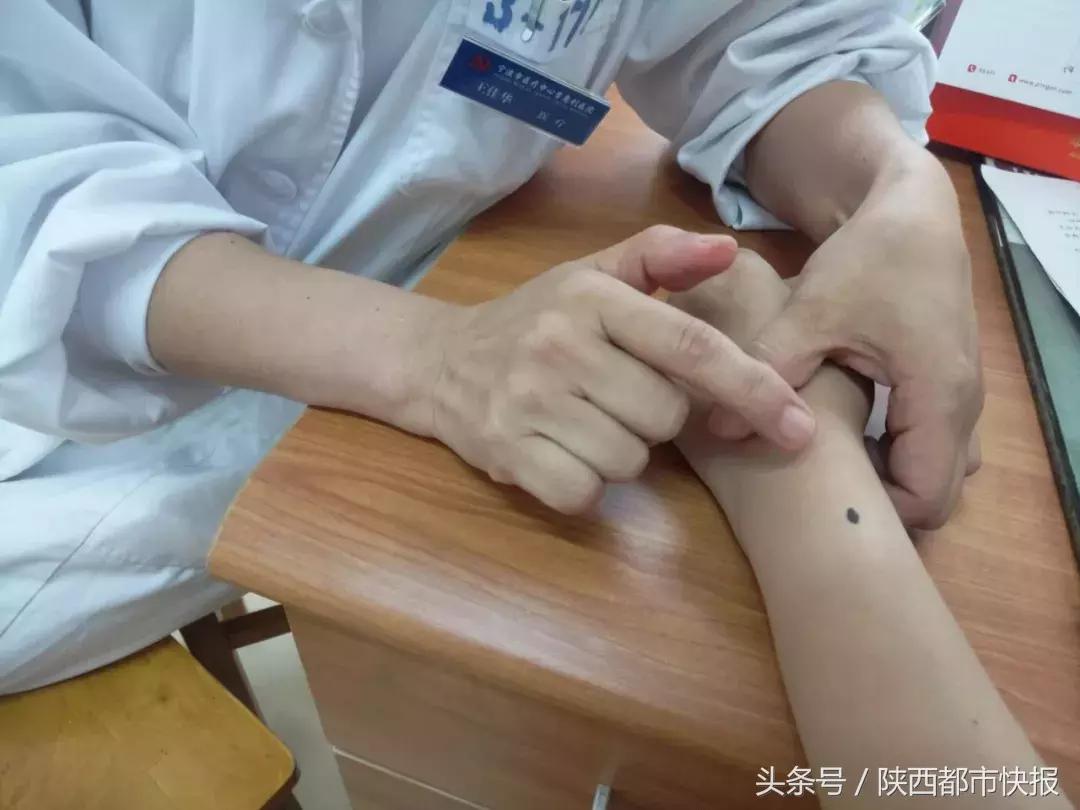 痣没切干净会诱发痣癌变吗,有痣且痣上长毛癌变