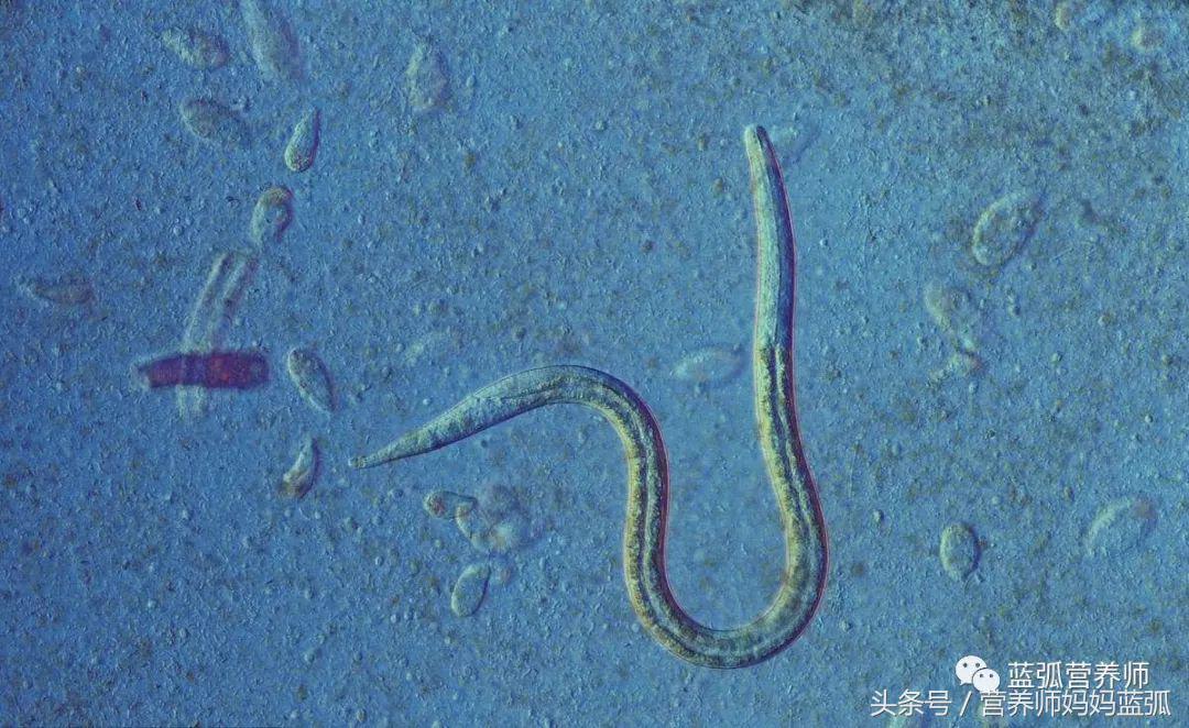 宝宝身上长的白斑是什么病,身上白斑和白癜风的区别