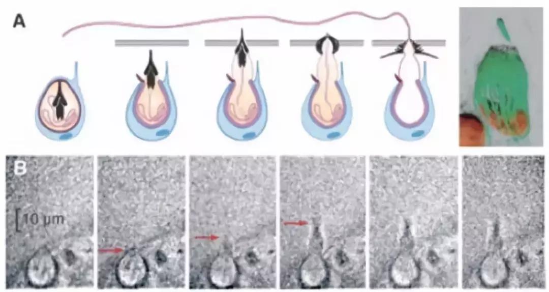 疼痛10大等级哪一级泪流满面,疼痛等级一百级分别都是什么