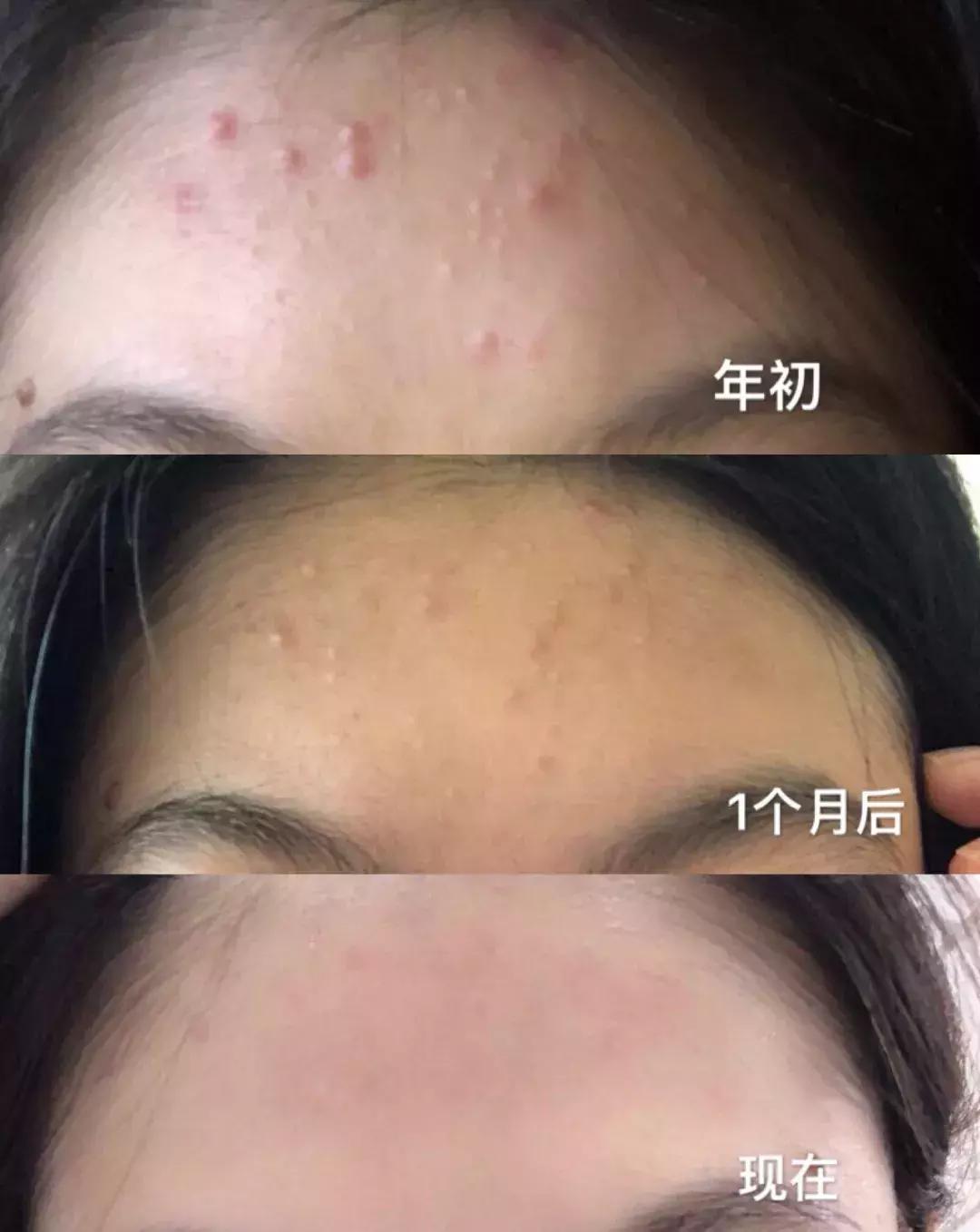 国货护肤测评面膜,很好用的国货护肤测评