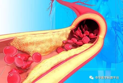 高血压停药的危害,高血压的危害视频