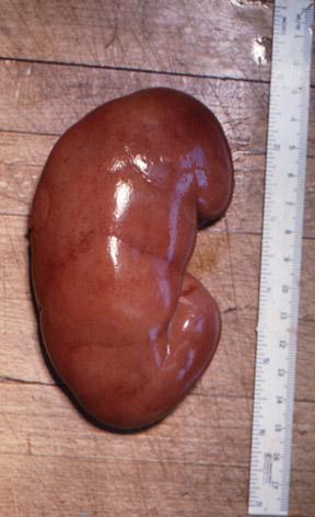 当年用肾换苹果手机的人后续,当初用肾换苹果的人怎么样了