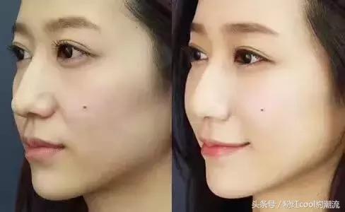 日本royal脐带血适合什么皮肤,royal脐带血精华