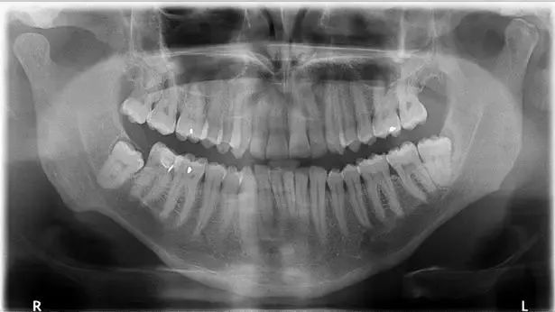 孩子爱问父母问题,孩子换牙期这些事家长必须要知道