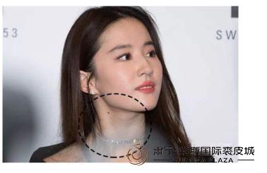 产后如何淡化妊娠纹和颈纹,肥胖纹遮盖妊娠纹