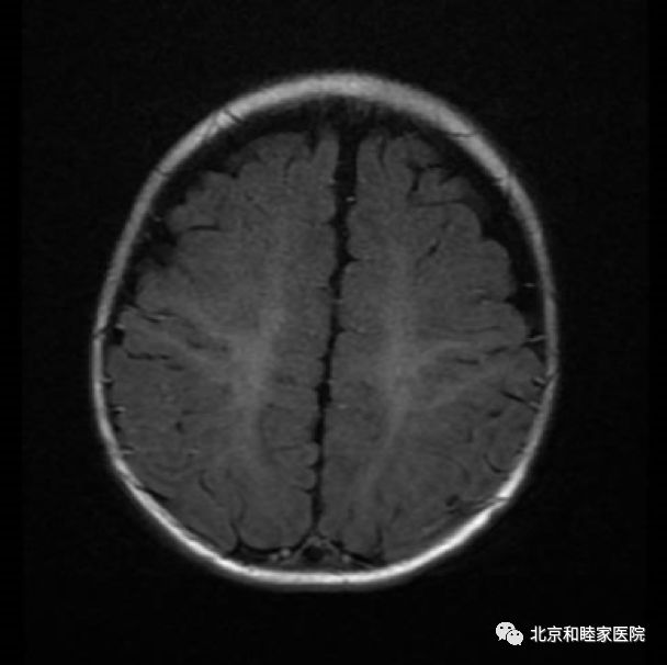 宝宝头部摔伤怎么办,小孩摔伤头部怎么办