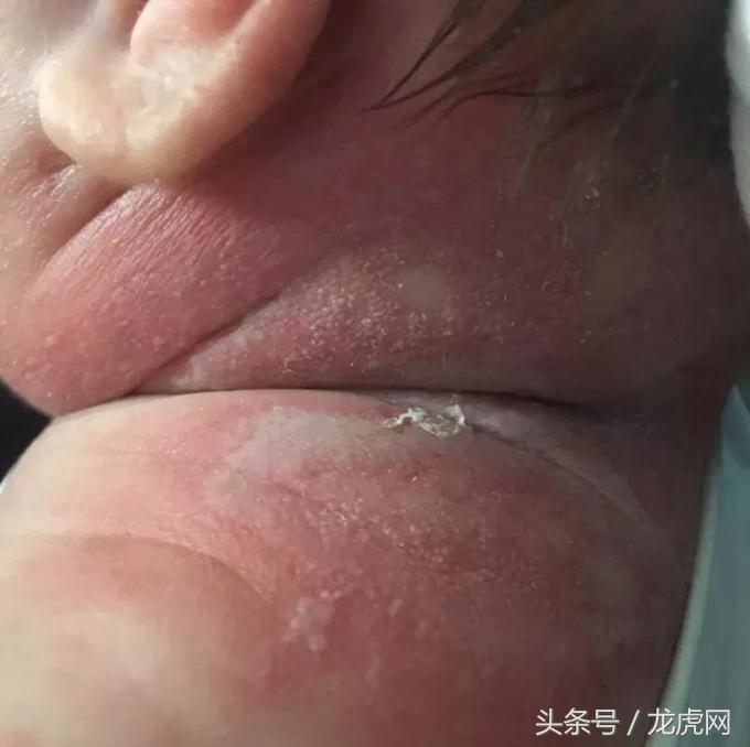 看到哪些虫子千万不要把它打死,看到这几种虫千万不要让宝宝碰