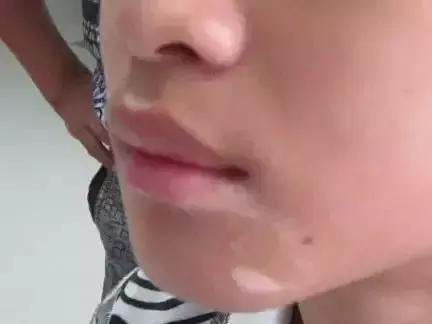 邯郸中药调理白癜风中医诊所,白癜风分型分期治疗的难度