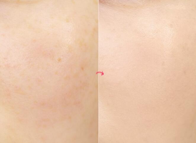 兰蔻持久粉底液氧化测评,兰蔻菁纯粉底下午不脱妆