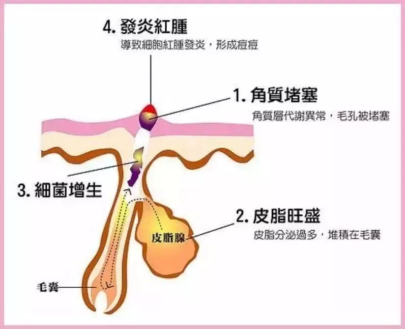 十大最坑爹护肤谣言视频,别再让这些谣言满天飞了