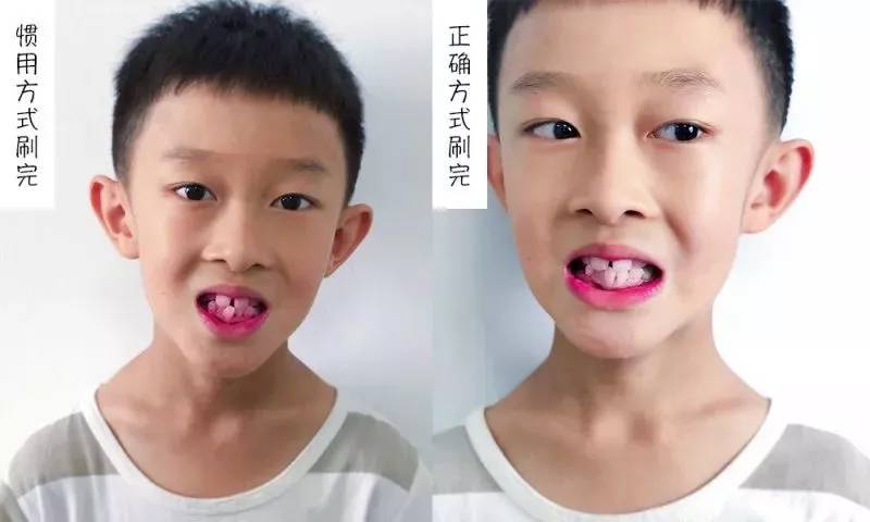 牙膏测评高露洁防蛀牙膏,牙膏推荐测评云南白药朗健