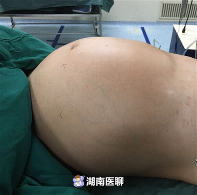 小病小痛应如何对待,小痛小病千万别不当回事