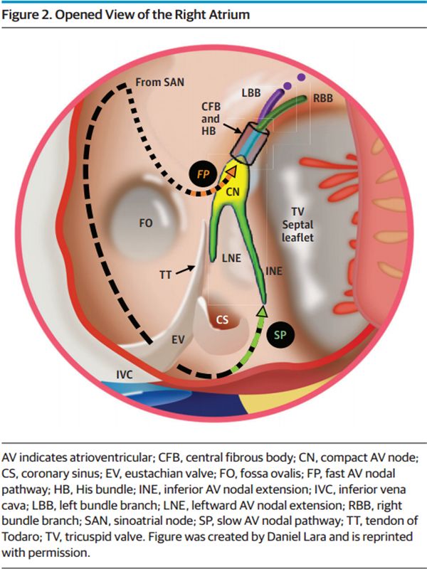 骨折手术后心跳20-40怎么回事,骨折病人手术后突然心梗