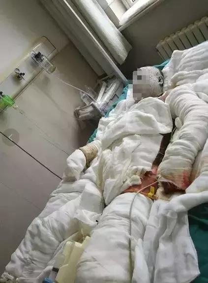 事发大连！不到俩月3人因它死亡！十多人严重受伤！