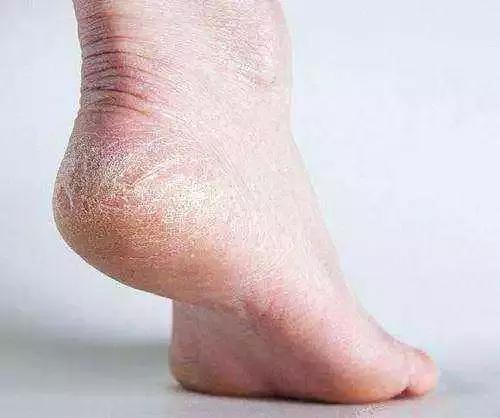 终于找到不磨脚又好看的鞋了！