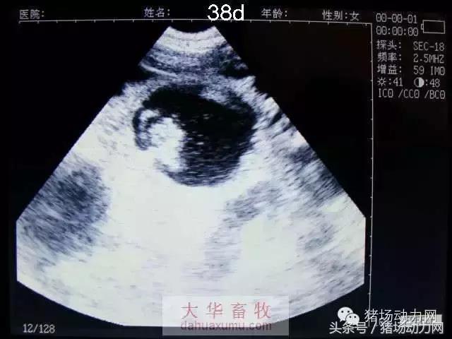 母猪b超图像如何看,怀孕100天的母猪b超影像