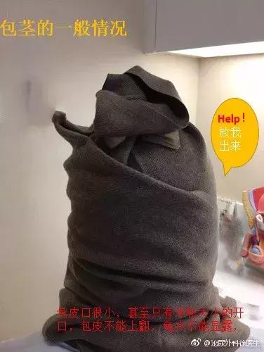 怎么判断自己的包皮要不要割,怎么才能知道自己的包皮要不要割