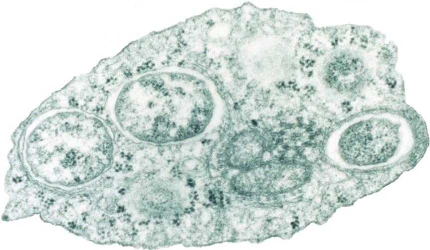 防蚊高手,夏季防蚊高手