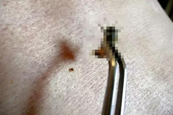 猫砂敷脸、蜜蜂毒疗，女明星怪异美容法真的有效？