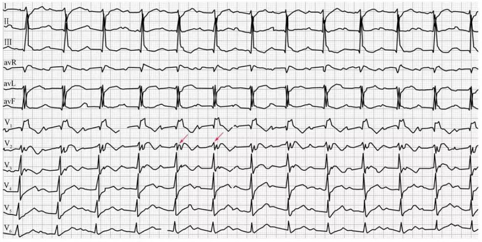 协和医院疑难杂症案例,协和医院疑难杂症视频