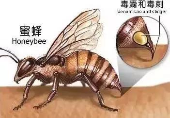 被蜜蜂或者马蜂蛰伤后的处理方式,外出游玩被毒蜂子蛰了急救措施