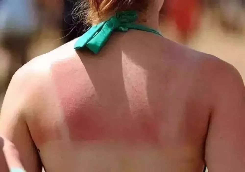 生活小妙招防中暑,生活小常识高温防暑