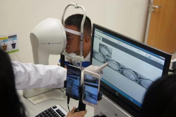 眼睛有螨虫的干眼怎么治疗,螨虫眼治疗视频