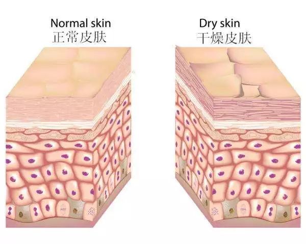 皮肤为什么锁不住水分,皮肤干锁不住水分用什么护肤品