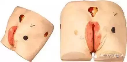 思密达有什么妙用,思密达的功效与作用及服用方法