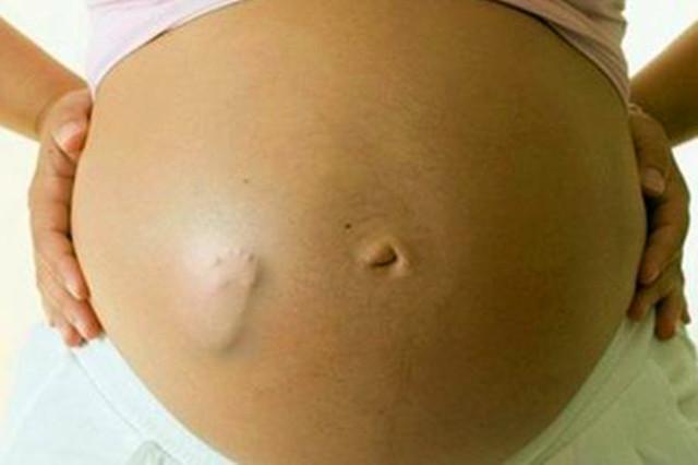 胎儿脑壳大是看哪里,胎儿这么大怎么从产道出来