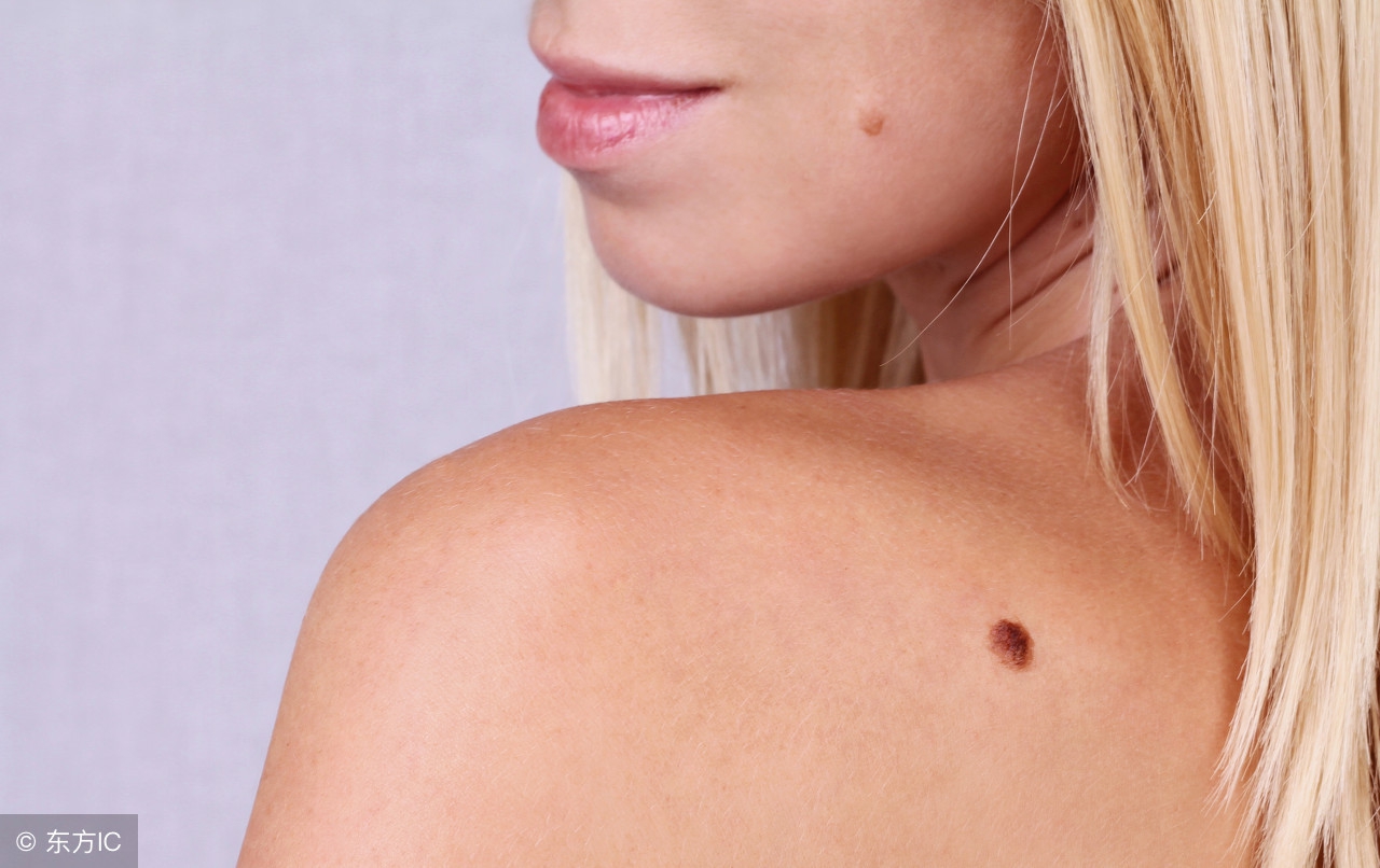 身体带红痣或黑痣的传说,身上黑痣红痣越来越多的原因