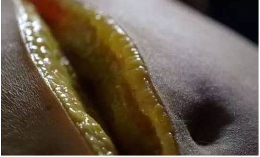 BBC解剖了一个200斤的女胖子，看完瑟瑟发抖！