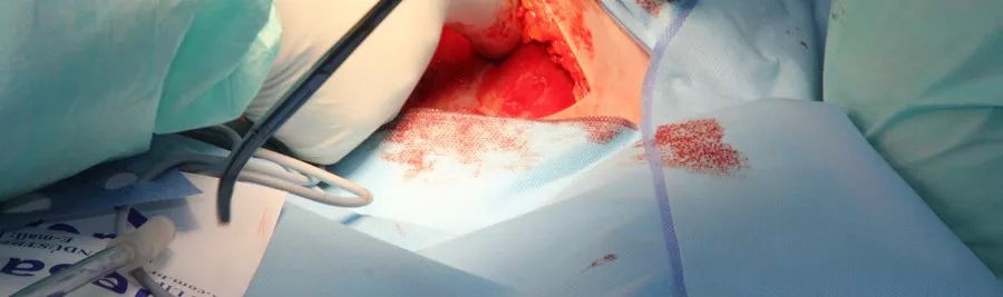 癌症病人发烧吃什么退烧,癌症病人发烧到38-39度是怎么回事