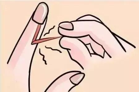 拔手指倒刺感染导致截指,为什么撕手上倒刺会导致截指