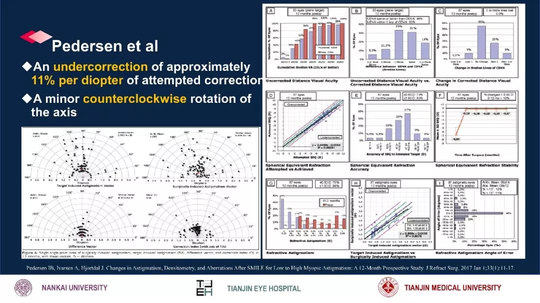 散光治疗技术突破,散光的矫正
