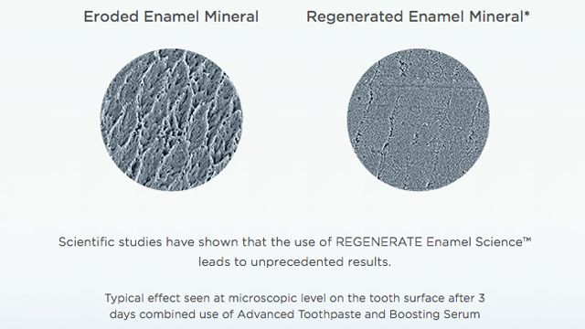 regenerate牙膏真能修复牙釉质吗,抗敏修复牙釉质牙膏排名第一名