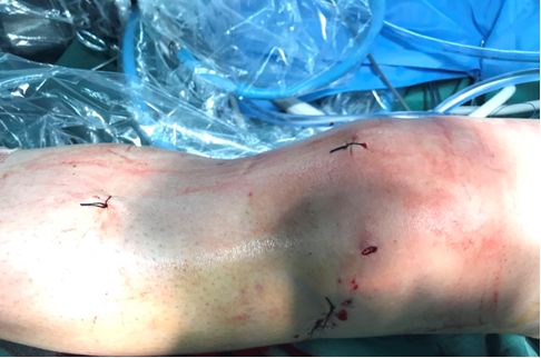 天玑加强版,新一代天玑