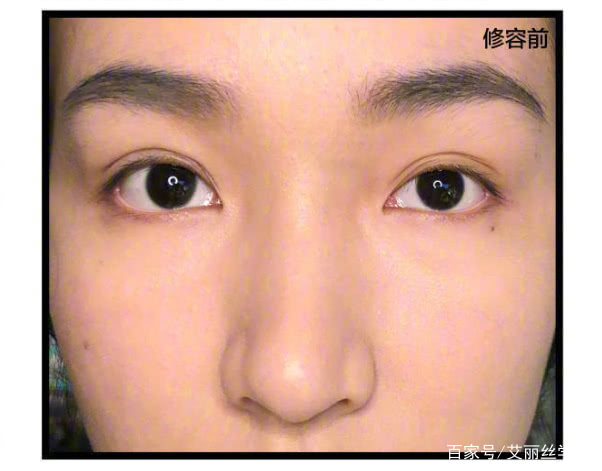如何拯救肉鼻子，这样做立马从扁塌鼻变欧美高鼻梁！
