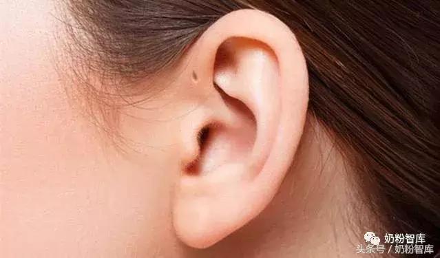 宝宝耳朵里小孔,宝宝耳朵上有个小孔怎么处理