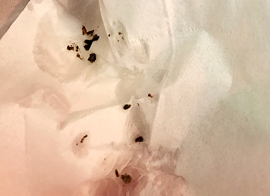 冰箱冷藏室有积水从哪来的？该怎么办？