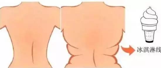 黑眼圈太重是不是身体出了问题,这段时间没睡好黑眼圈太重了