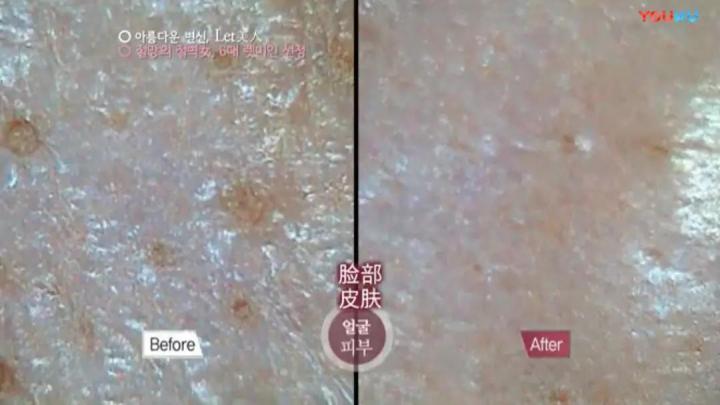 生完孩子被老公嫌弃太胖后续,生完孩子以后肚皮被老公嫌弃