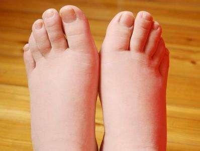 轻松摆脱大象腿,从容地解决问题