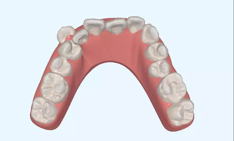 超实用的拔牙小技巧有哪些,拔牙知识图片